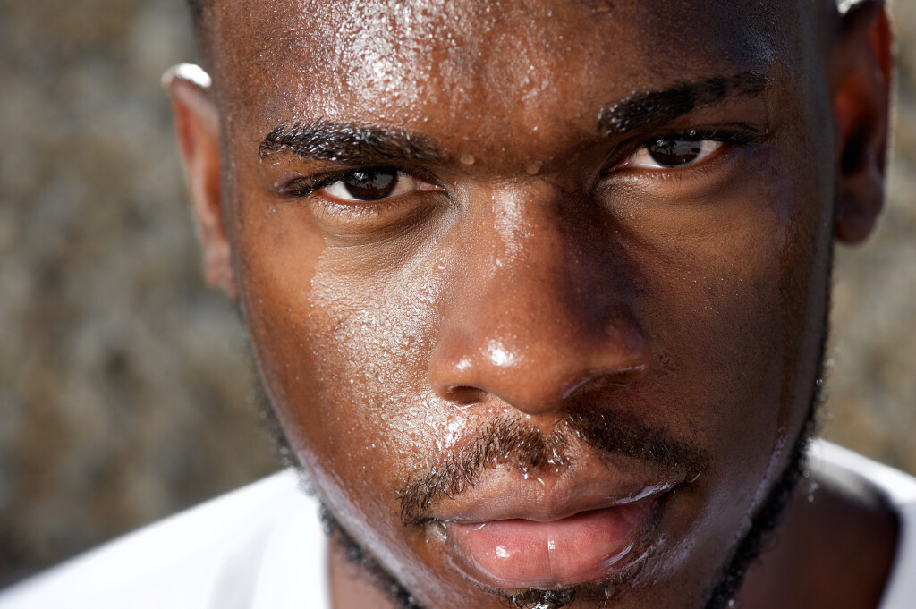 Uzroci pretjeranog znojenja